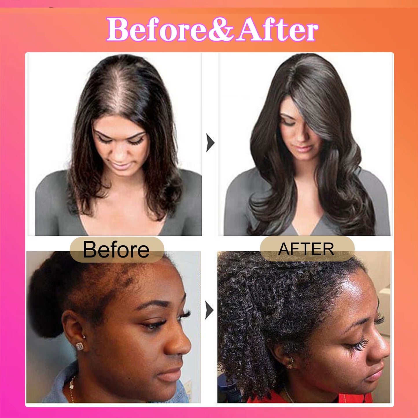 Raw Batana Oil for Hair Growth 100% Pure and Natural Batana Oil for Treating Hair Loss Anti-Breakage Hair Loss Treatment