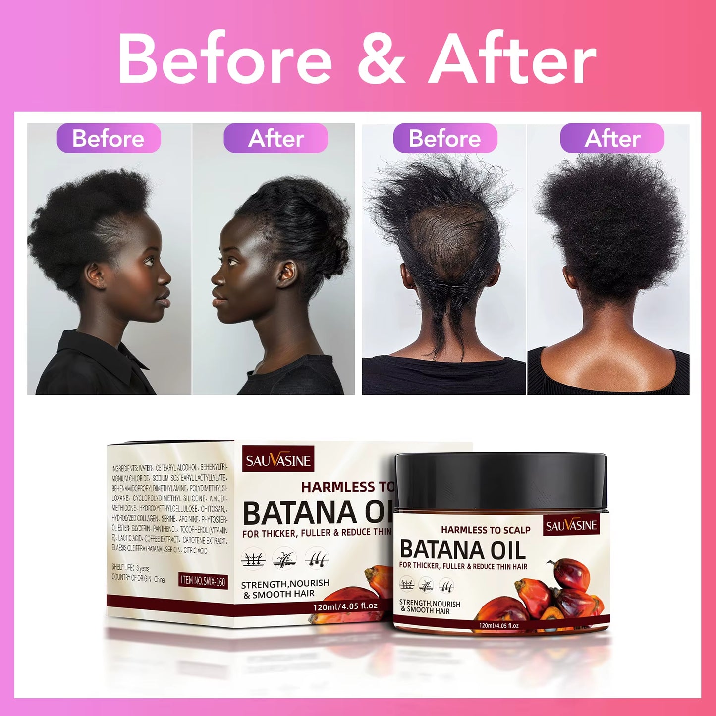 Raw Batana Oil for Hair Growth 100% Pure and Natural Batana Oil for Treating Hair Loss Anti-Breakage Hair Loss Treatment