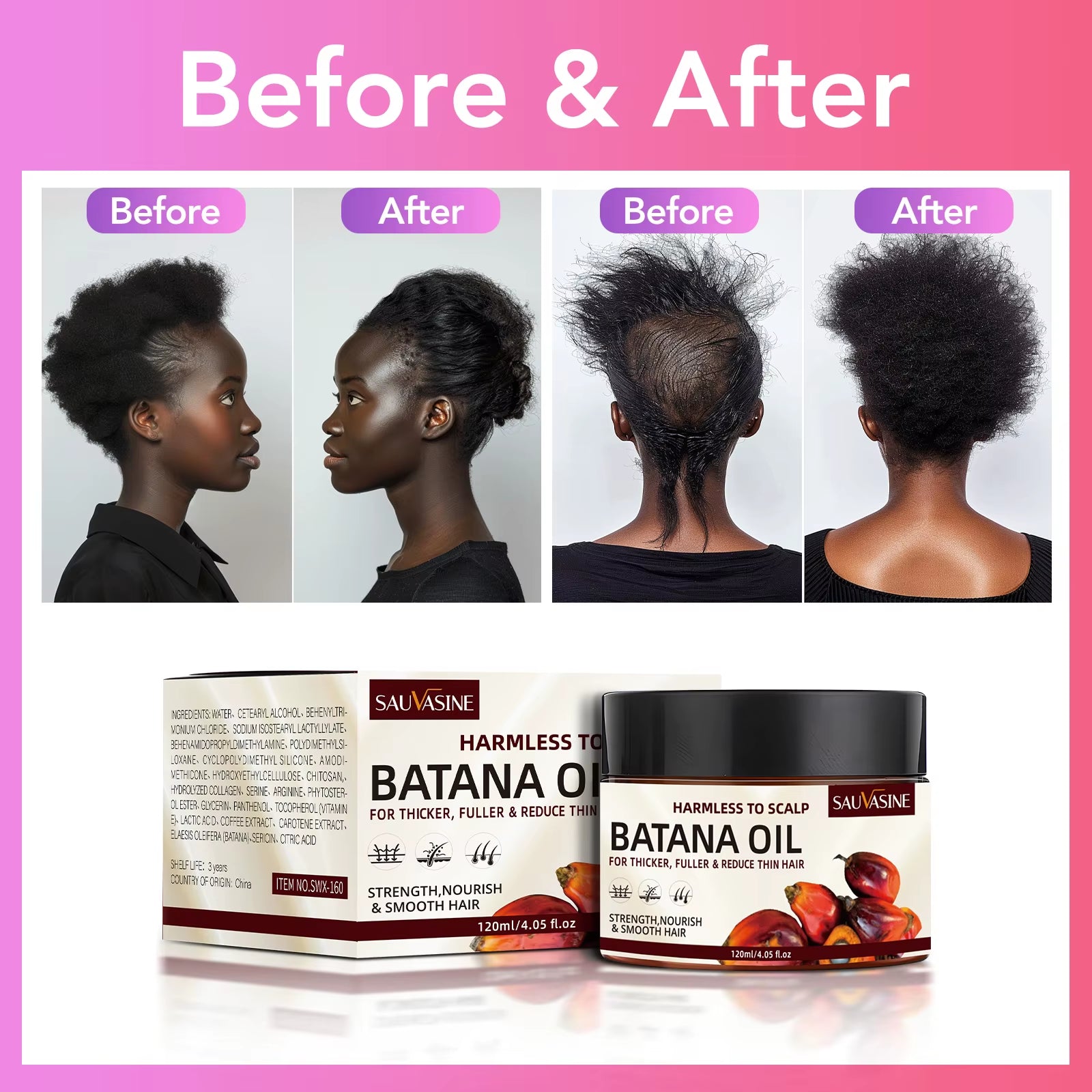 Raw Batana Oil for Hair Growth 100% Pure and Natural Batana Oil for Treating Hair Loss Anti-Breakage Hair Loss Treatment